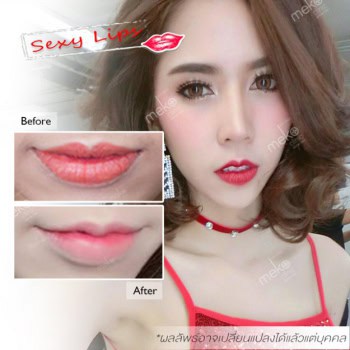 ปากกระจับ หมอมนัส เมโกะ คลินิก คุณเจน