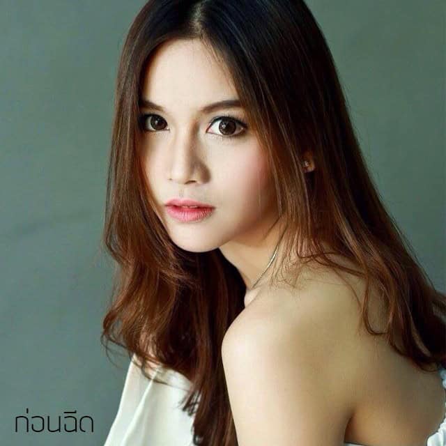 ฉีดโบ หมอมิ้ว เมโกะ คลินิก คุณนิ้ง