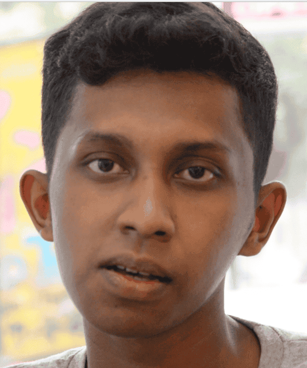 เสริมจมูก หมอมนัส เมโกะคลินิก ยังLetmein