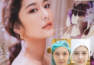 Thermage Signature dr.milk mekoclinic