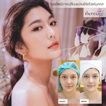 Thermage Signature dr.milk mekoclinic