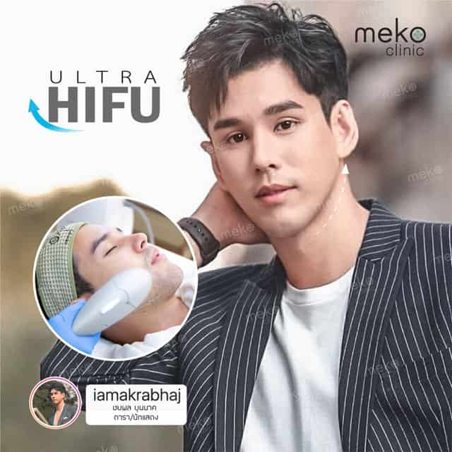 Hifu dr.ake mekoclinic คุณอั๋นชยพล