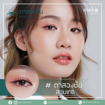 ตาสองชั้น เมโกะคลินิก mekoclinic