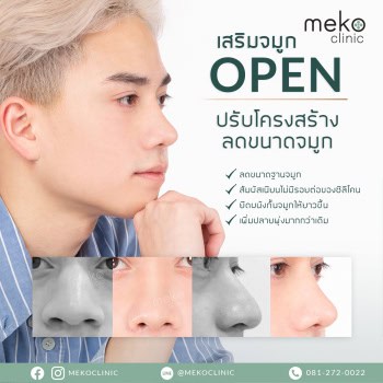 เสริมจมูก-open-เมโกะคลินิก-5