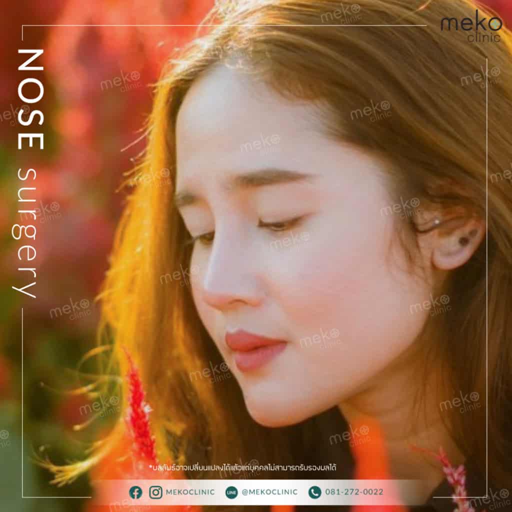 เสริมจมูก ทรงสโลปธรรมชาติ โดย หมอยง เมโกะ คลินิก (คุณจรรลินญา)