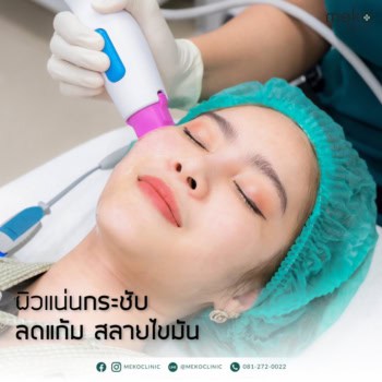 thermage-เมโกะ-คลินิก-คุณแพม