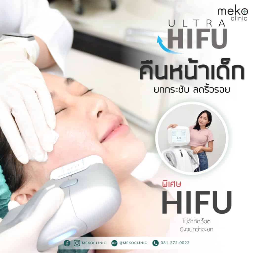 Hifu-เมโกะ-คลินิก-คุณเอมมี่