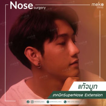 แก้จมูก สายเกา หน้าละมุนด้วยเทคนิคSuperNose Extension
