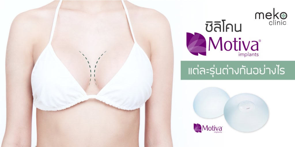 ซิลิโคน-Motiva-แต่ละรุ่นต่างกันอย่างไร