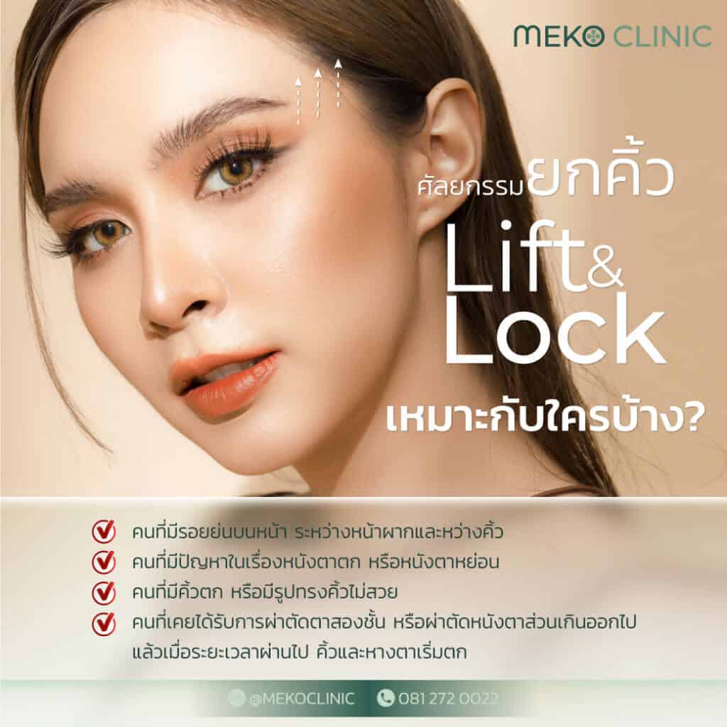 ศัลยกรรมยกคิ้ว Lift&lock เหมาะกับใครบ้าง