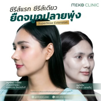 banner-เสริมจมูก-ซีรีส์แรก-1040x1040-01