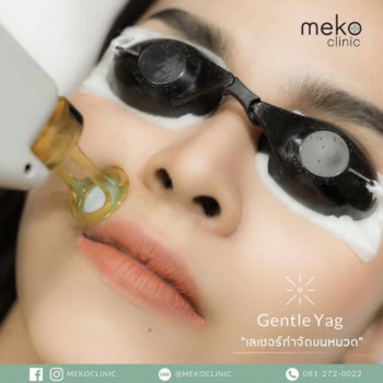 meko clinic gentle yag