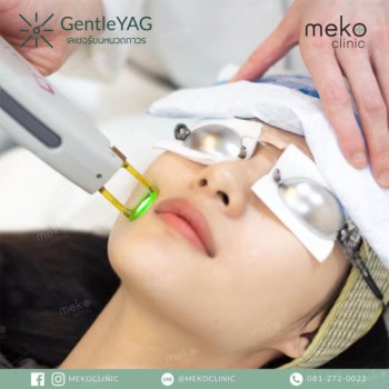 meko clinic gentle yag