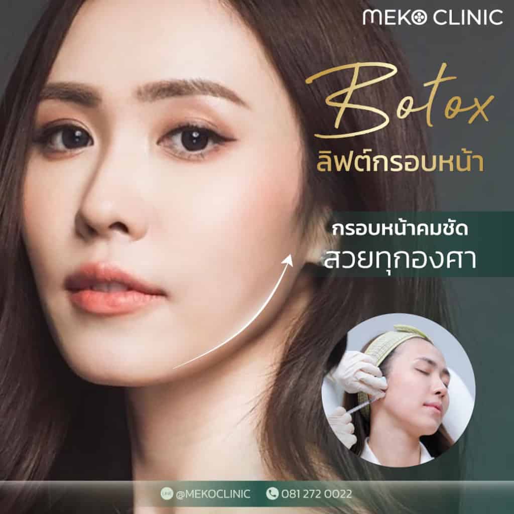 โบท็อกซ์ ลิฟต์กรอบหน้าหมอเอกธิดา