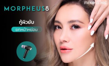 Morpheus8-กู้ผิวยับ-ยกหน้าหย่อน
