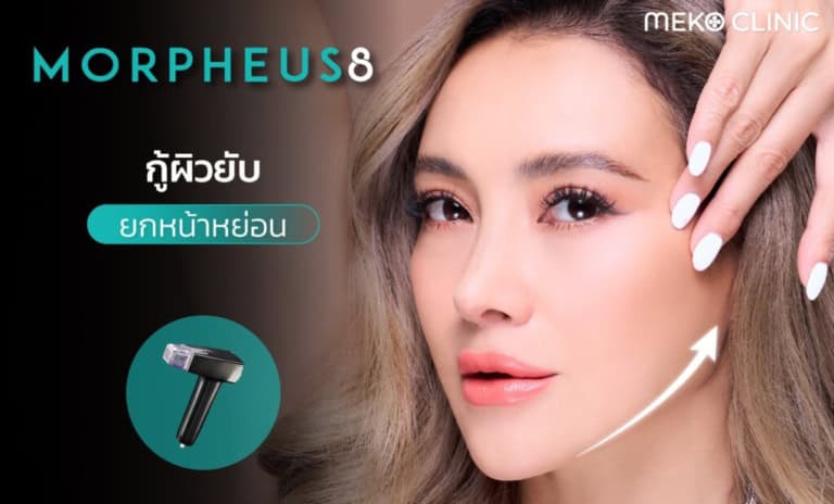Morpheus8-กู้ผิวยับ-ยกหน้าหย่อน