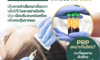PRP Hair Treatment กระตุ้นเซลล์รากผม-1
