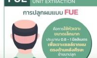 เทคนิคการปลูกผม FUE(Follicular Unit Hair Transplant)-1
