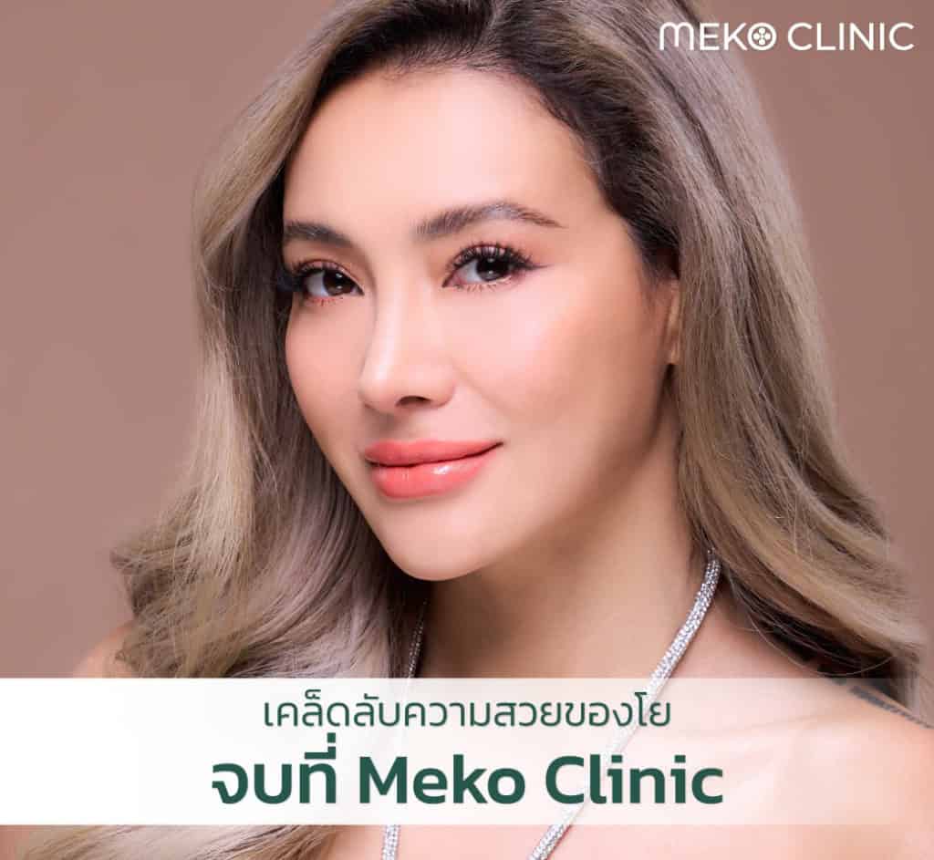 Sub Brow Lift ยกหางตาตก