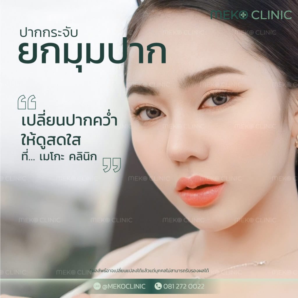 ศัลยกรรมปาก ตกแต่งริมฝีปาก เหมาะกับใคร และมีประโยชน์อย่างไร-2