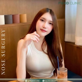 รีวิวแก้จมูกแบบ Open ครบ 1 ปี (nose open surgery)