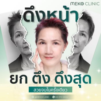 หน้าสวย ย้อนวัยด้วย Radiant Facelift