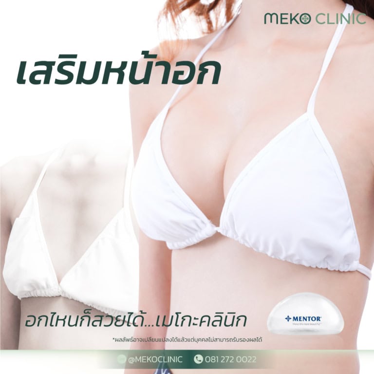 ศัลยกรรมหน้าอก มีกี่แบบ เตรียมตัวก่อน – หลังเสริม อย่างไรบ้าง