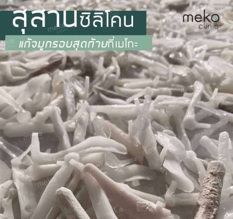 5 ขั้นตอน เช็คซิลิโคนปลอมเสริมจมูก ดูยังไงให้ ปลอดภัยไร้กังวล