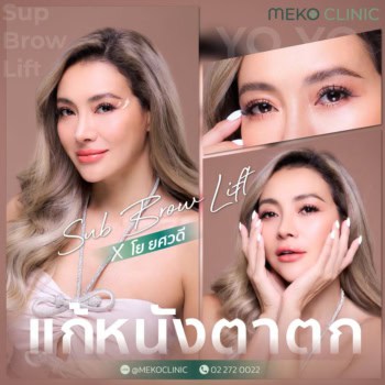 โยมั่นใจ Subbrow-lift ที่เมโกะคลินิก