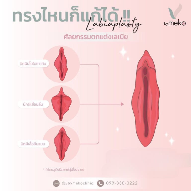 เลเบีย คืออะไร? แตกต่างอย่างไรกับ รีแพร์ และมีข้อดีอะไรบ้าง