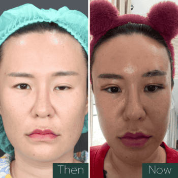 โรค กล้าม เนื้ออ่อน แรง เกิด จาก อะไร ต้องดูรีวิวนี้