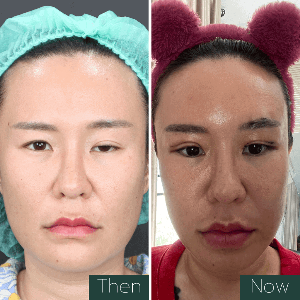 โรค กล้าม เนื้ออ่อน แรง เกิด จาก อะไร ต้องดูรีวิวนี้