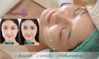 Thermage ยกกระชับ ปรับรูปหน้า