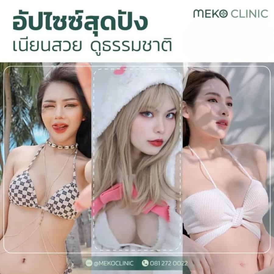 อัปไซซ์สุดปัง เนียนสวย ดูธรรมชาติ