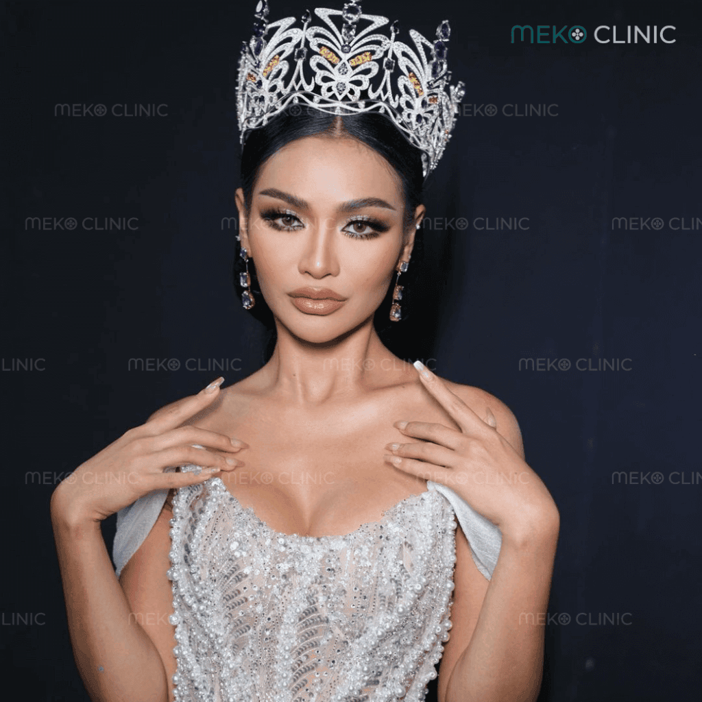 รีวิวเสริมหน้าอกนางงาม คุณมุก กานต์ฤทัย ทัศบุตร-9