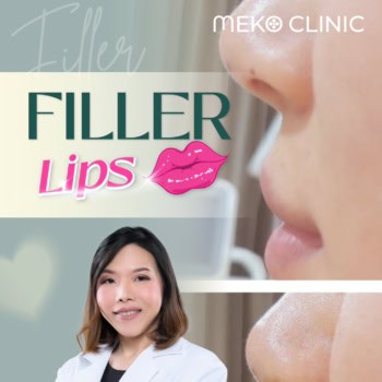 รีวิวฟิลเลอร์ปาก เคสคุณหมอเตย เติมเต็มปากอวบอิ่มเซ็กซี่แบบธรรมชาติ ทั้งสายฝ.และสายเกาหลี