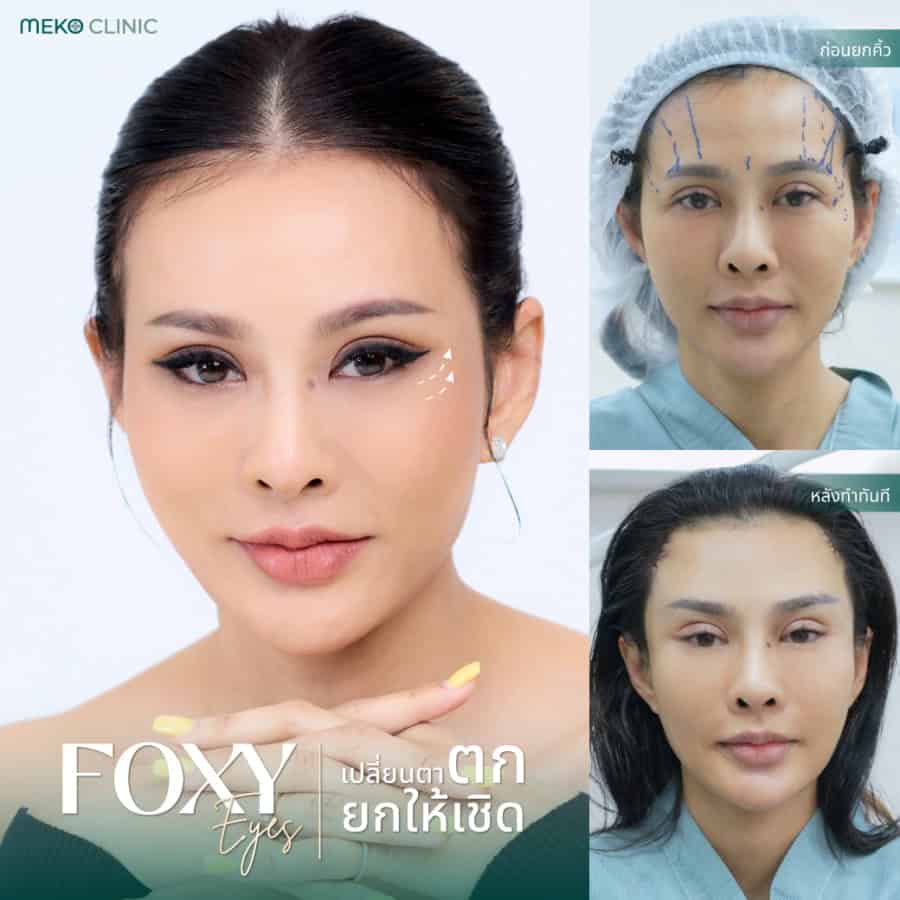 Foxy eyes เทรนตาเฉี่ยว เปรี้ยวแบบสายฝอ