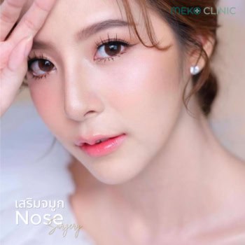 banner-การเสริมจมูกเหมากับใคร