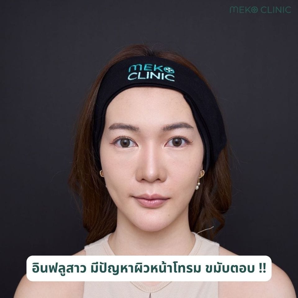 ขมับตอบ ผิวหน้าโทรม ทะเลทราย talaysinee