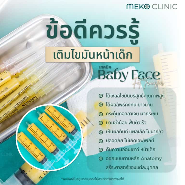 เติมไขมันหน้าดีไหม มีข้อดี-ข้อเสีย อย่างไร เติมไขมันหน้า vs เติมฟิลเลอร์ เลือกแบบไหนดี