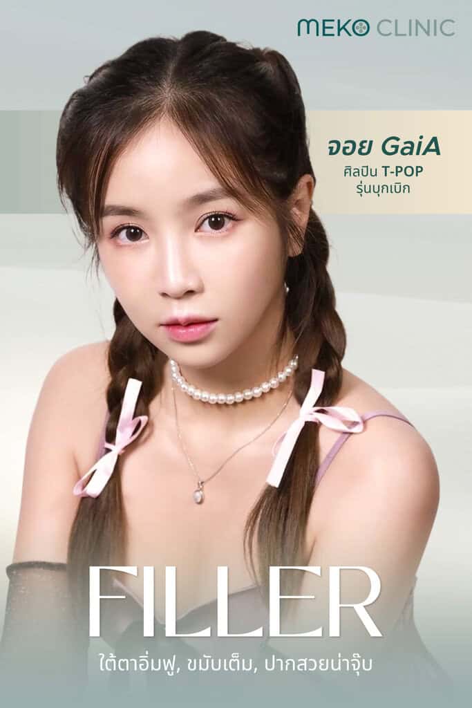 เติมฟิลเลอร์ Juvederm จอย ไกอา-6