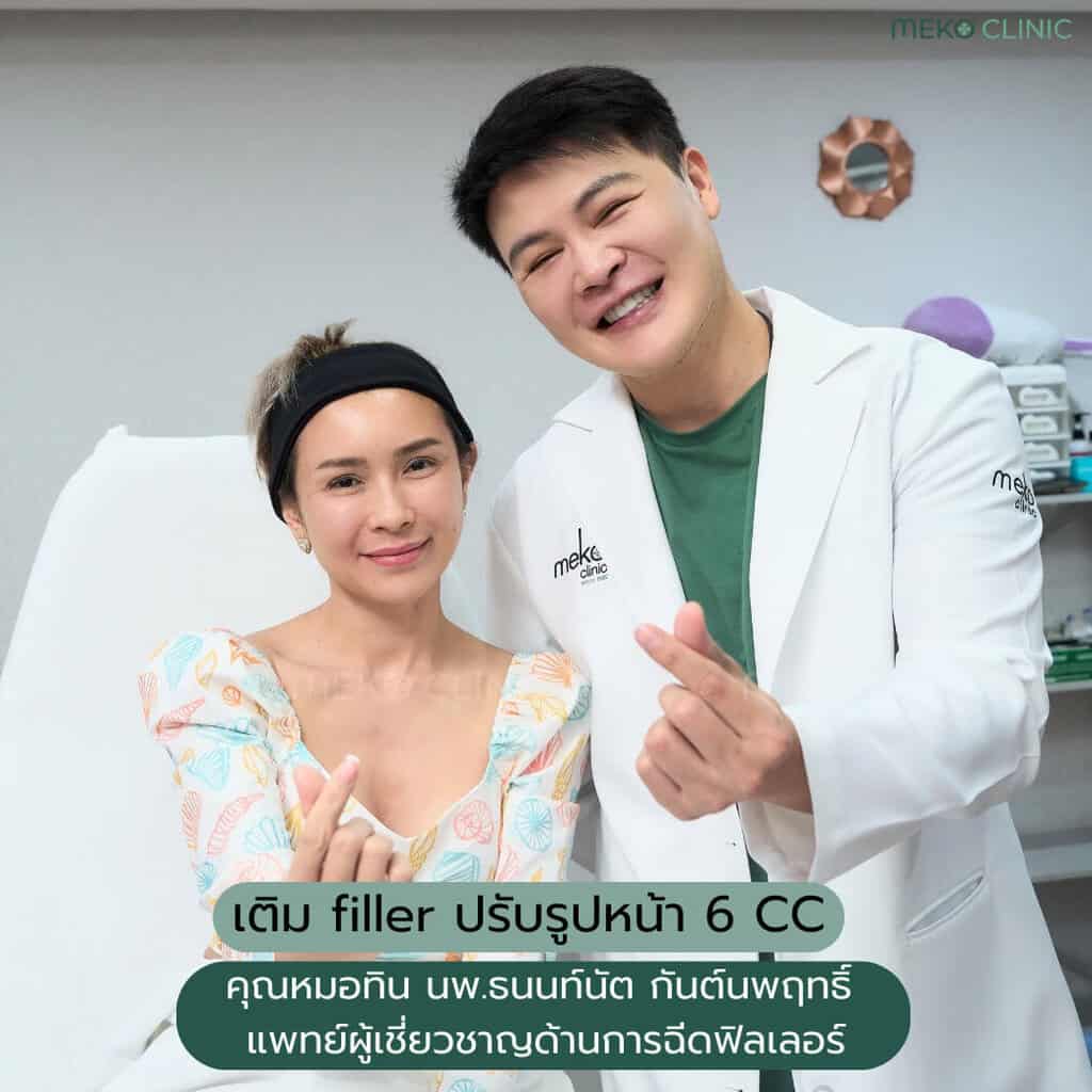 เติม filler ปรับรูปหน้า 6 CC