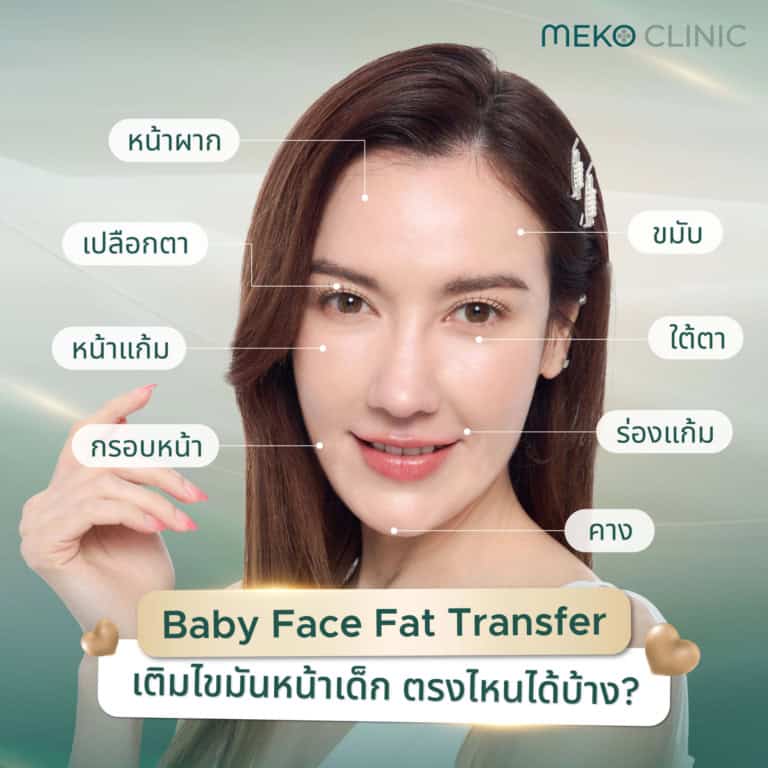 วิธีฉีดไขมันหน้าเด็ก และขั้นตอนในการฉีดไขมันหน้า