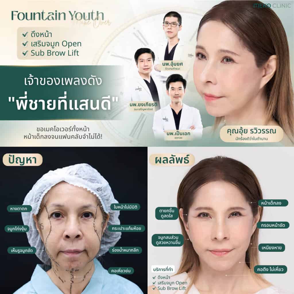 รีวิวศัลยกรรมดึงหน้า ดึงคอ คุณจ๋า-1
